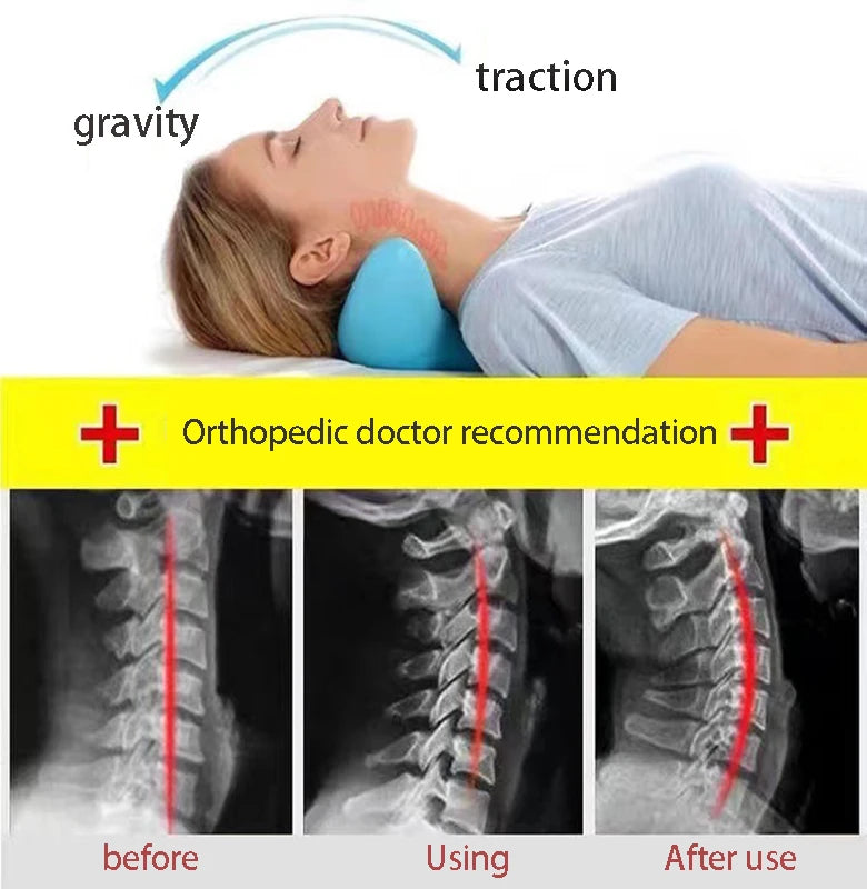 Cervical Spine Alignment Neck Stretcher for Daily Pain Relief
