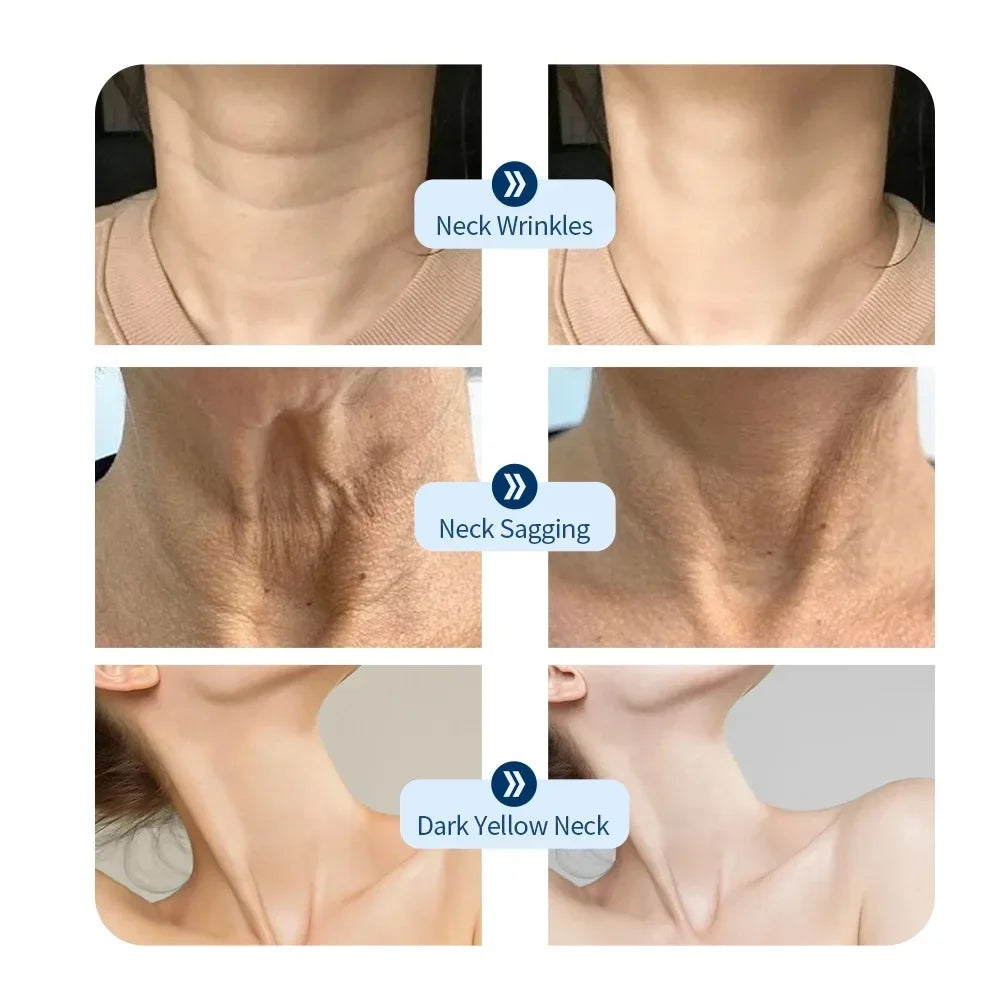 Radiant Neck Rejuvenation Mask™