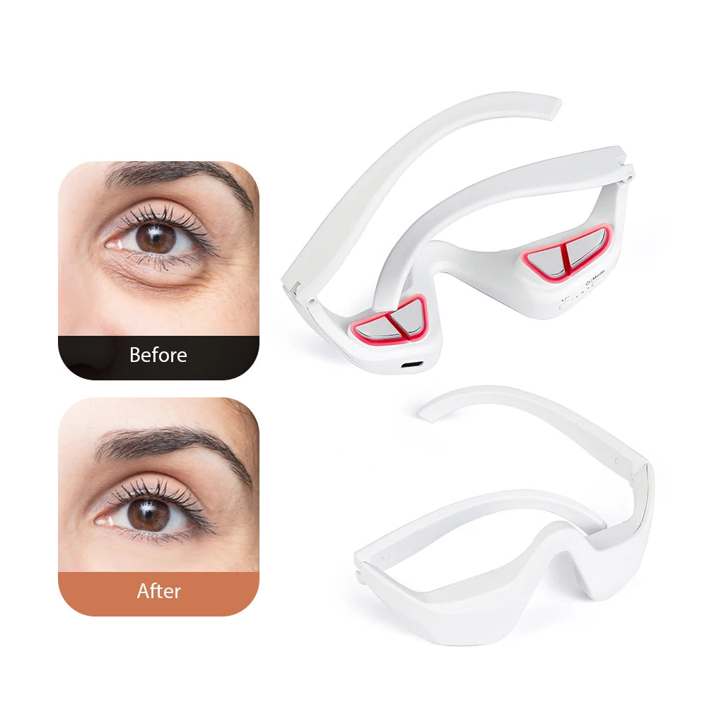 3D Eye Massager for Dark Circles, Puffiness & Eye Strain