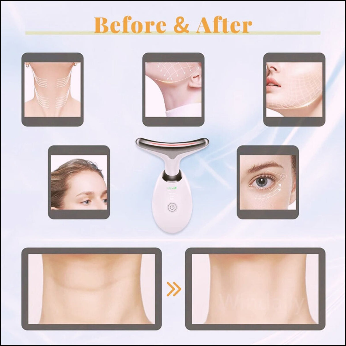 🔥 Skin Tightening & Facial Lift Massager