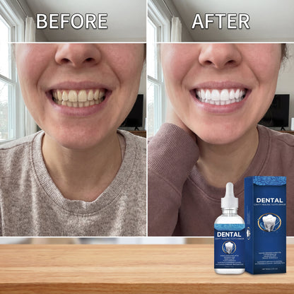 Enamel Repair Drops
